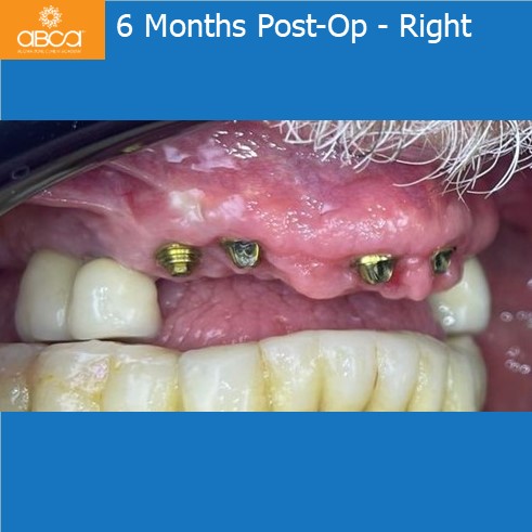 Clinical Case