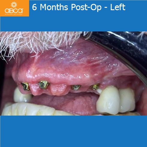 Clinical Case
