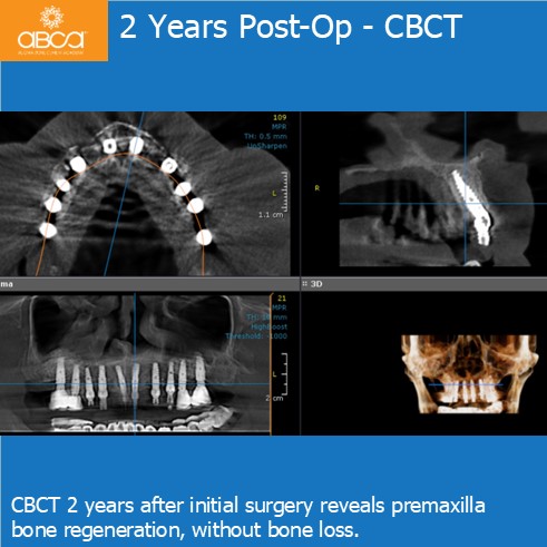 Clinical Case