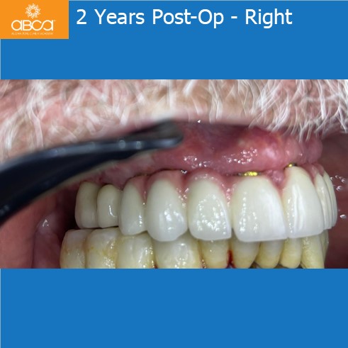 Clinical Case