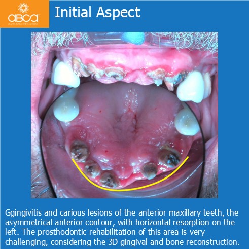 Clinical Case