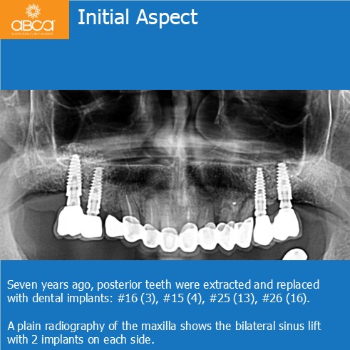 Clinical Case