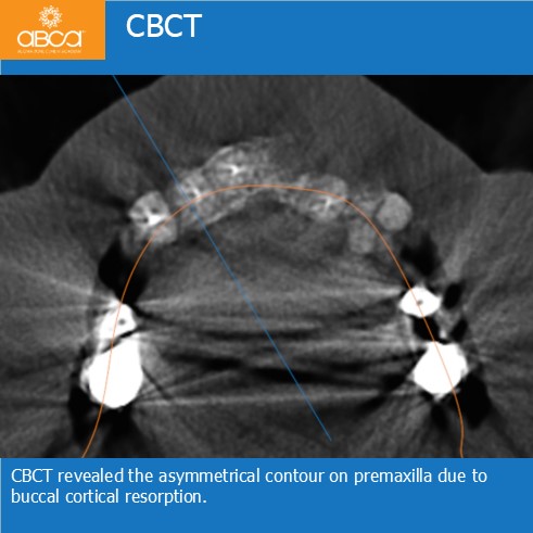 Clinical Case