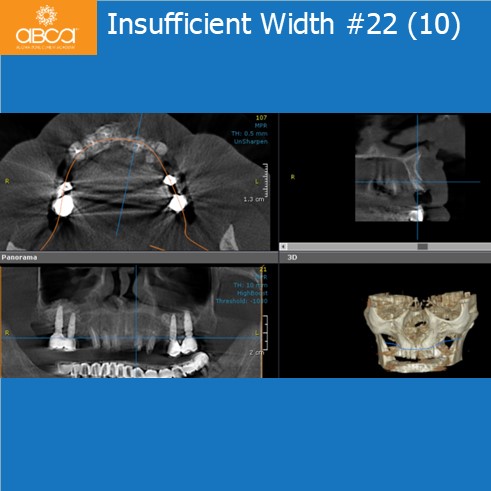 Clinical Case