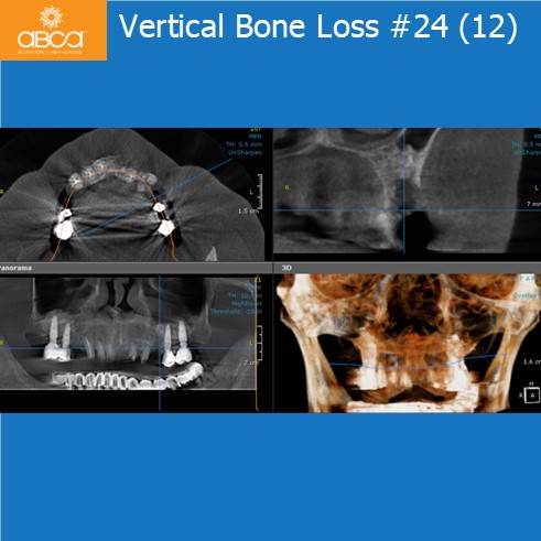 Clinical Case