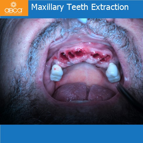 Clinical Case