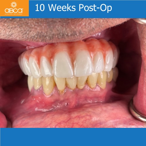 Clinical Case