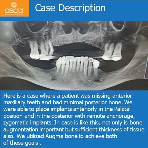 Clinical Case