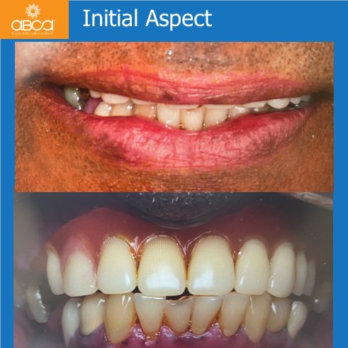 Clinical Case
