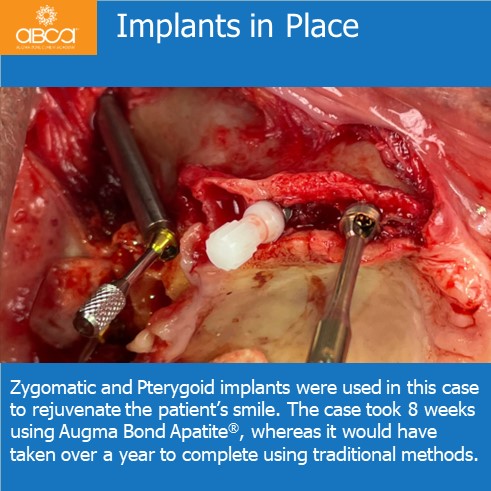 Clinical Case