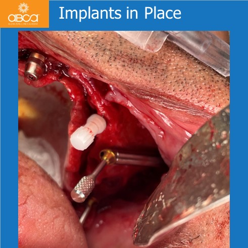Clinical Case