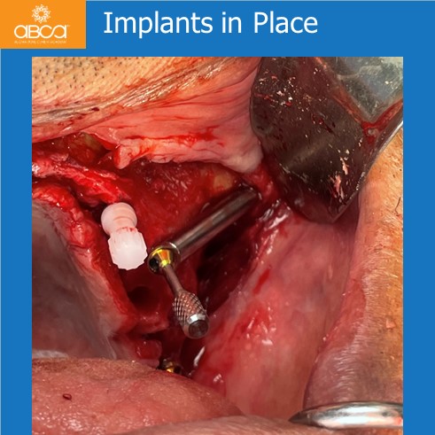 Clinical Case