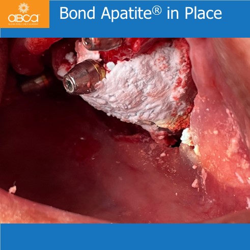 Clinical Case