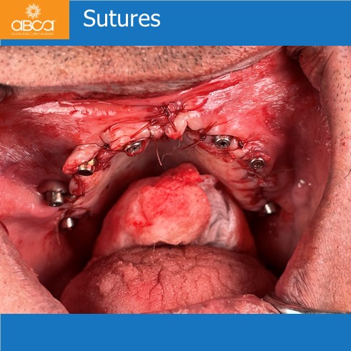 Clinical Case