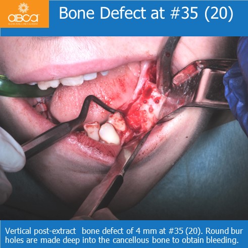 Clinical Case