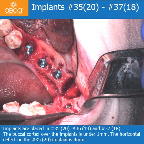 Clinical Case