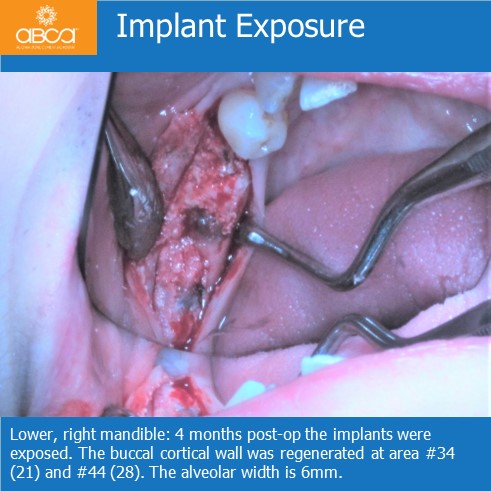 Clinical Case