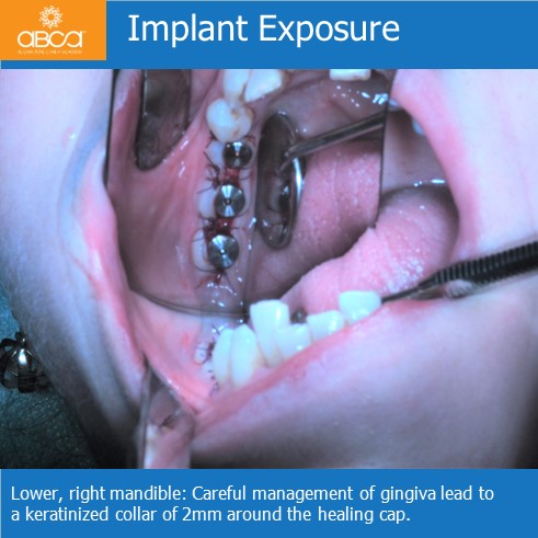 Clinical Case