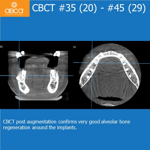 Clinical Case