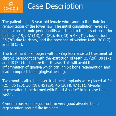 Clinical Case