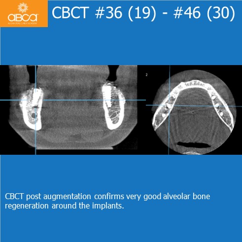 Clinical Case