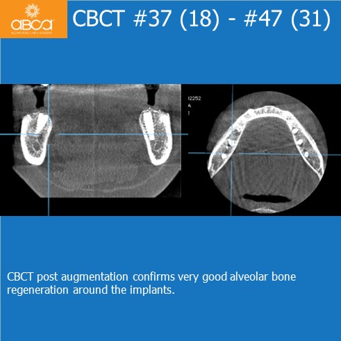 Clinical Case