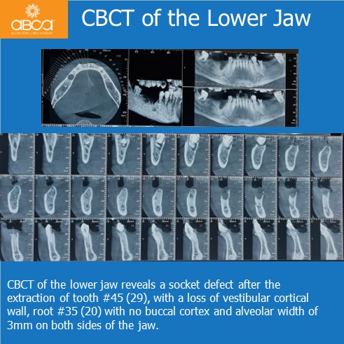 Clinical Case