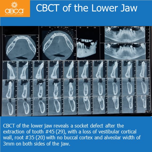 Clinical Case