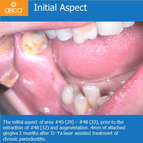 Clinical Case