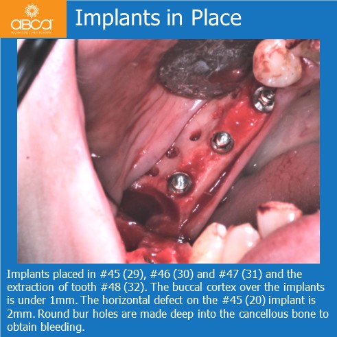 Clinical Case