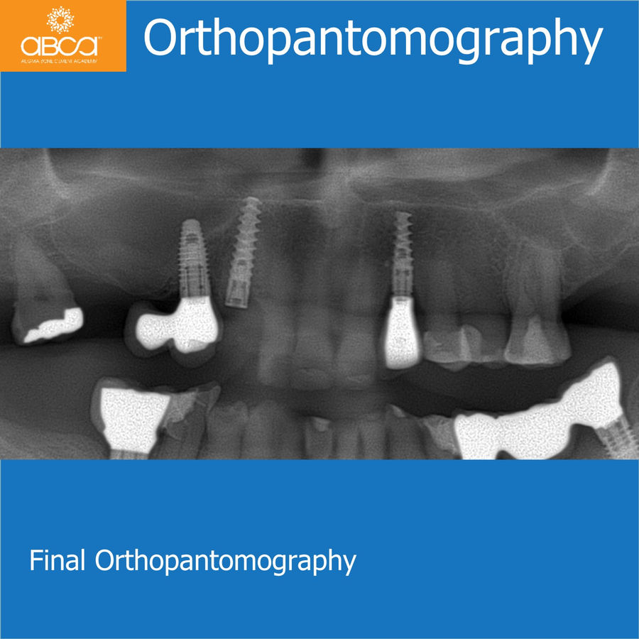 Orthopantomography | Final Orthopantomography