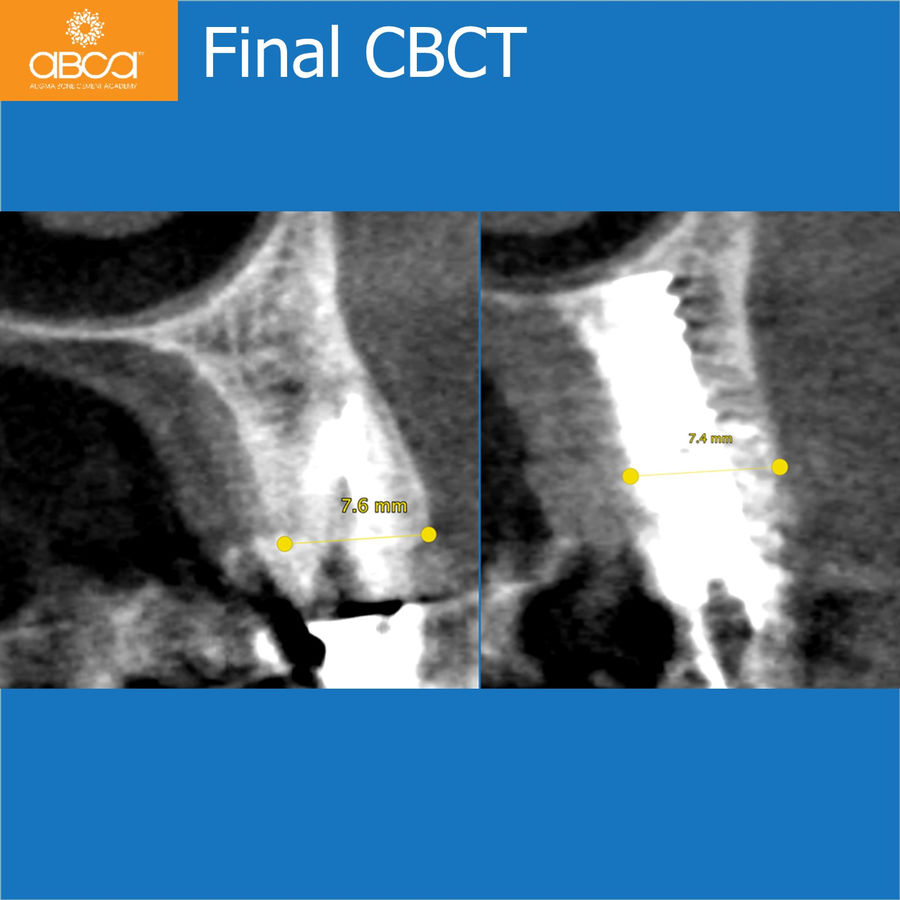 Final CBCT