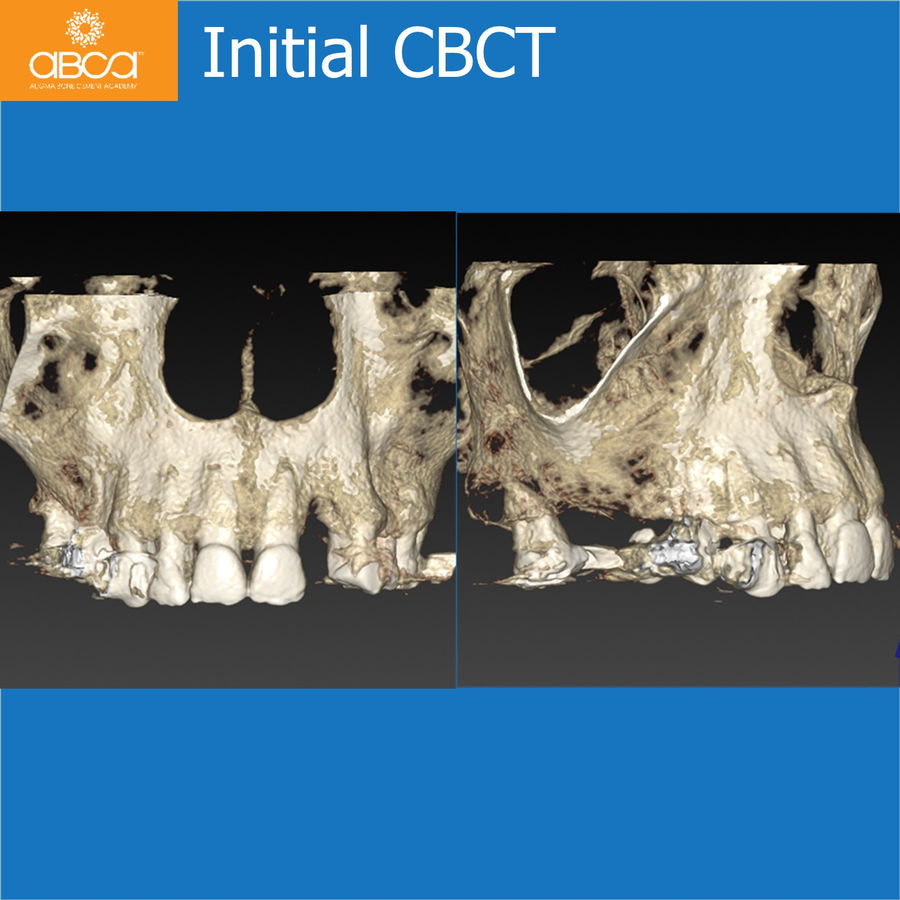 Initial CBCT | 1