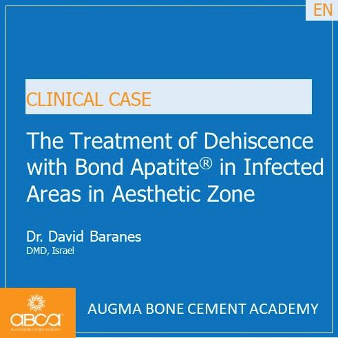 The Treatment of Dehiscence with Bond Apatite in Infected Areas in Aesthetic Zone