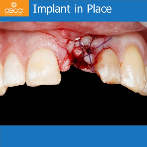 Clinical Case