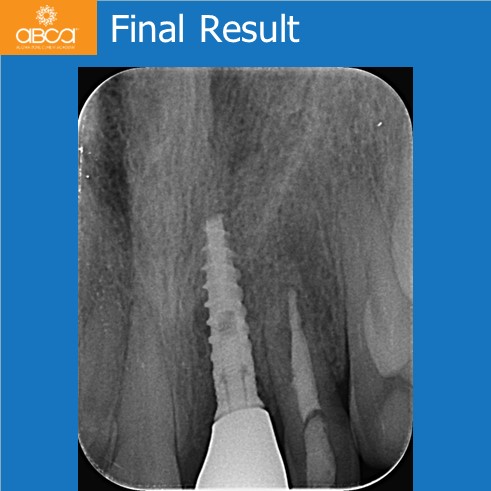 Clinical Case