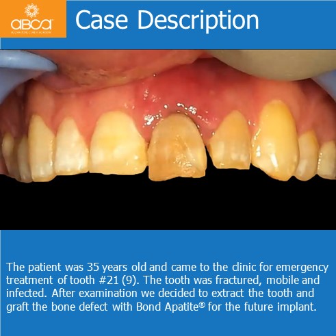 Clinical Case