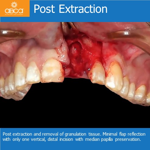 Clinical Case