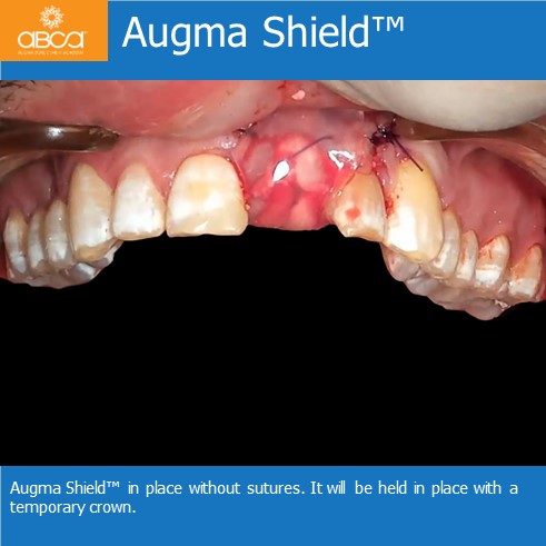 Clinical Case