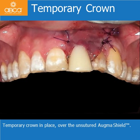 Clinical Case