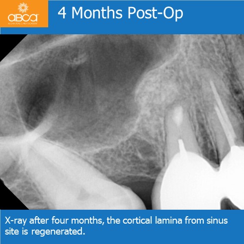 Cyst #15 (4)