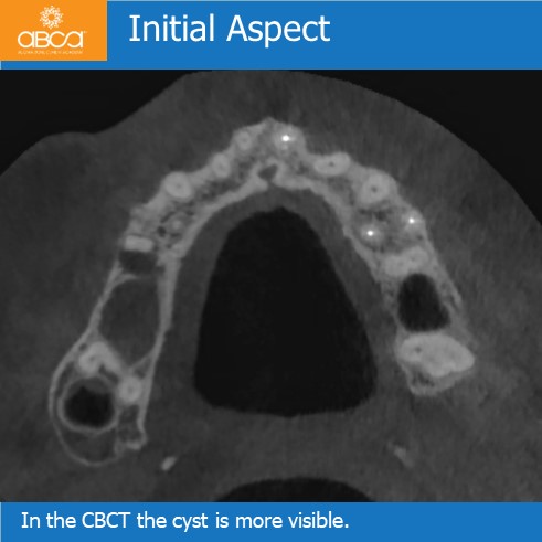 Cyst #15 (4)