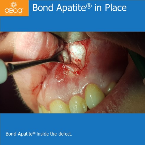 Clinical Case
