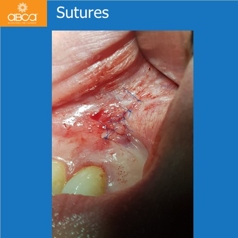 Clinical Case