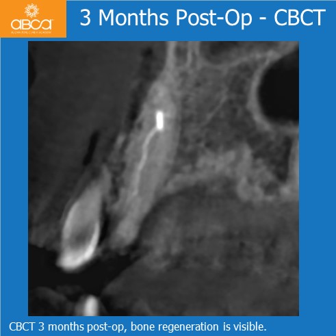 Clinical Case