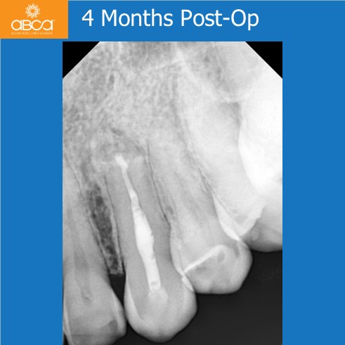 Clinical Case