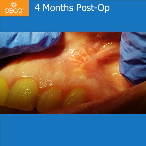 Clinical Case