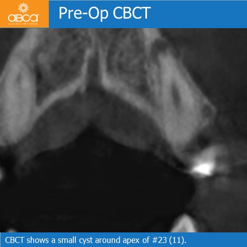 Clinical Case