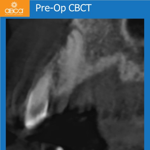 Clinical Case