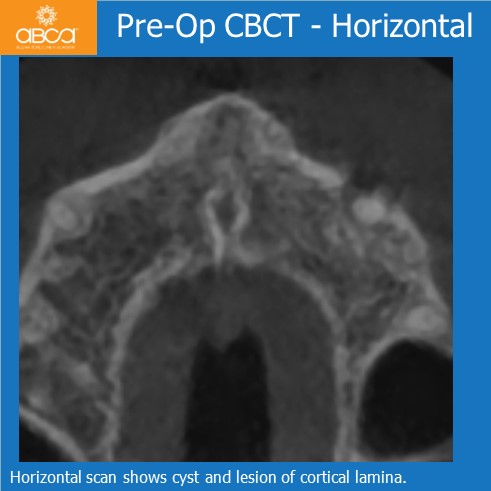 Clinical Case
